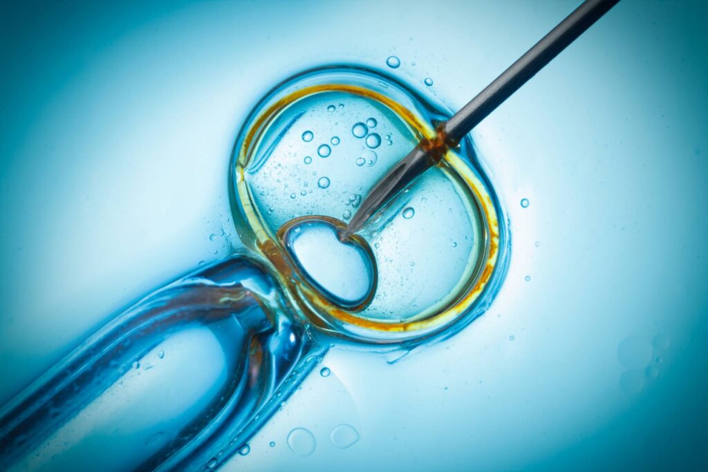 ICSI – Intracytoplasmic Sperm Injection